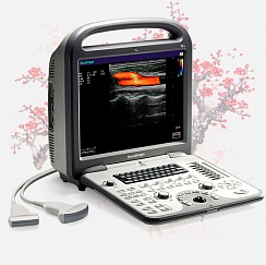 Ультразвуковой сканер Sonoscape S6Pro